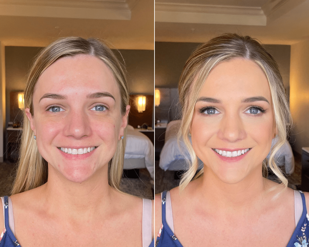 before and after teen